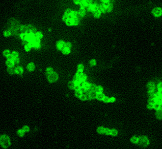 Fluorescent-labeled Francisella tularensis, 1000x magnification. Credit: CDC.